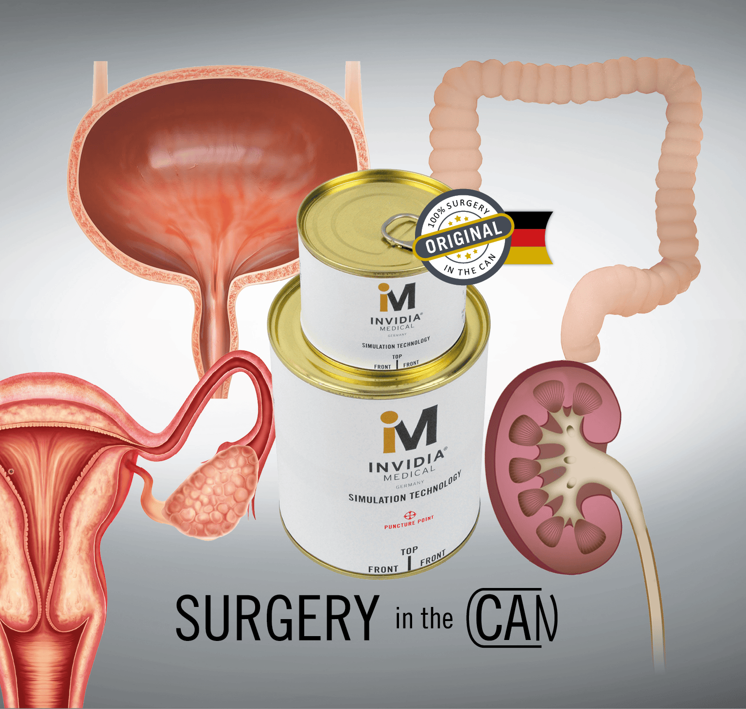 Illustration medizinischer Organe mit Dosen in der Mitte; Etikett „Surgery in the Can“.